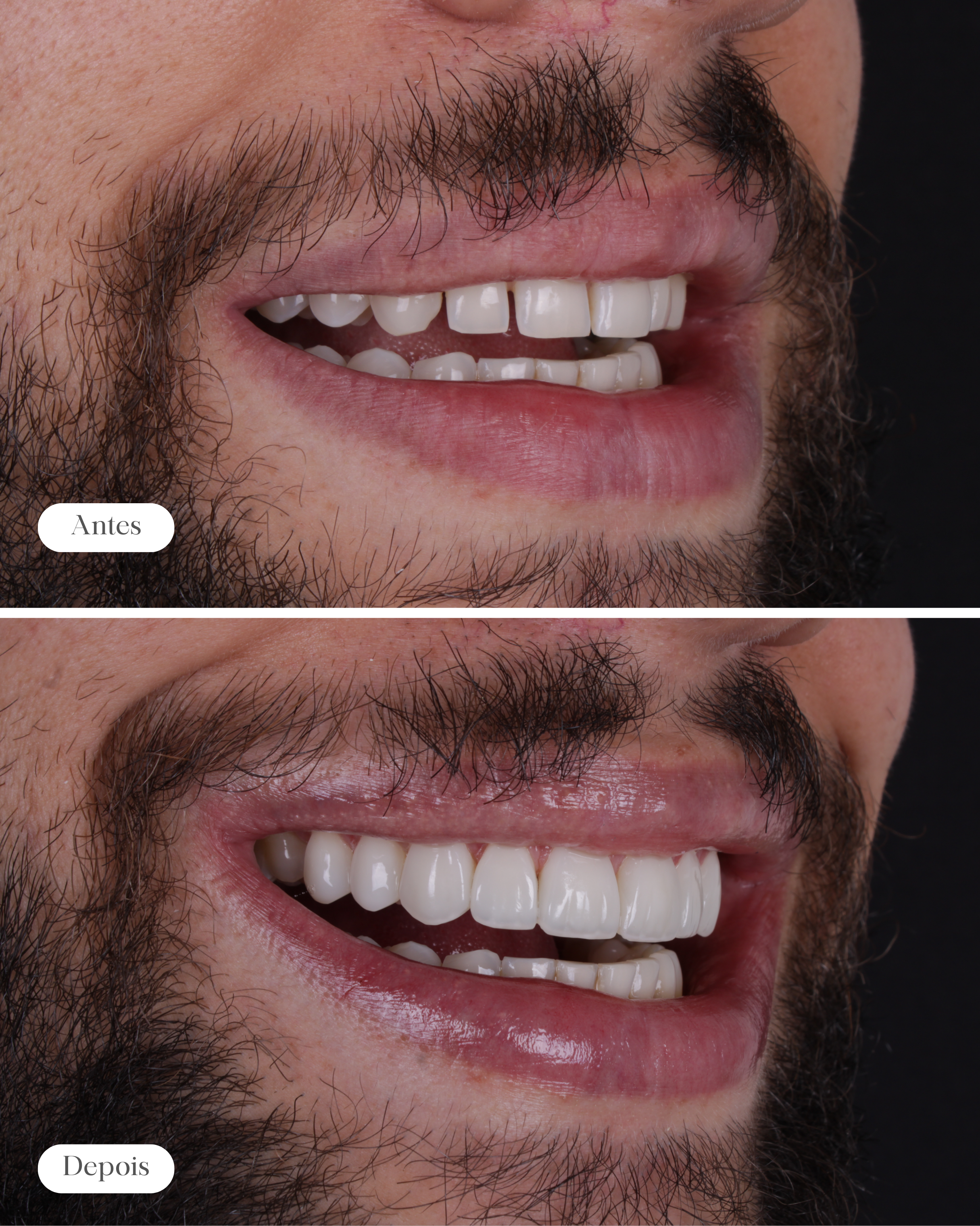 Sorriso transformado